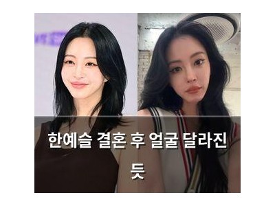 한예슬 결혼 후 얼굴 달라진 듯